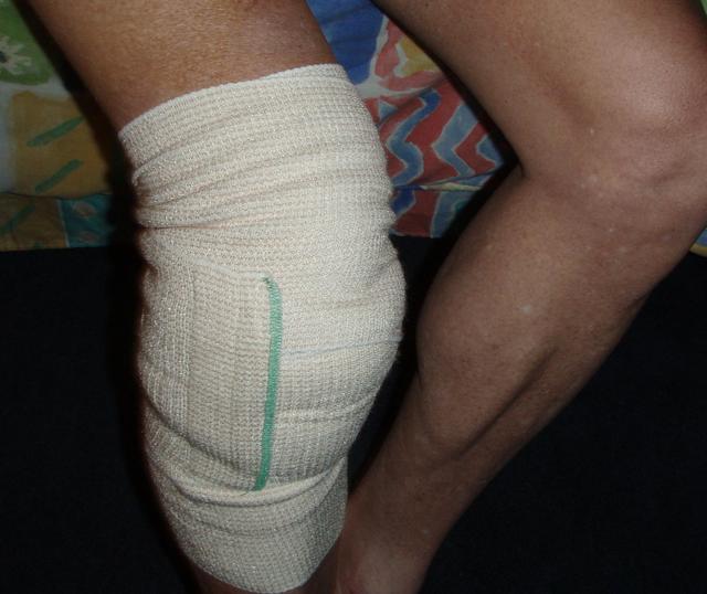 Arthroscopy_004_c